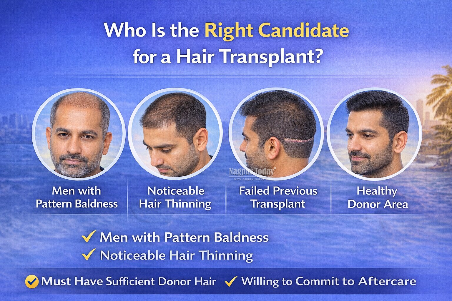 Who Is the Right Candidate for a Hair Transplant?