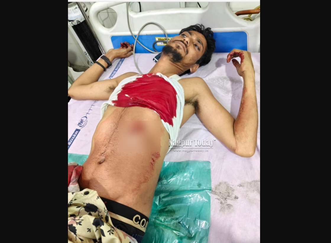 कामठीत तरुणावर चाकूने जीवघेणा हल्ला;उधारीच्या पैशांवरून वाद चिघळला