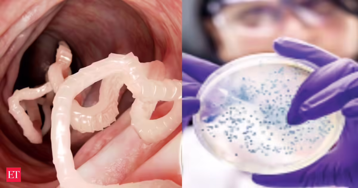 Mysterious parasite outbreak in US sickens 300 people: Check Cyclospora symptoms, treatment and precautions you sould take