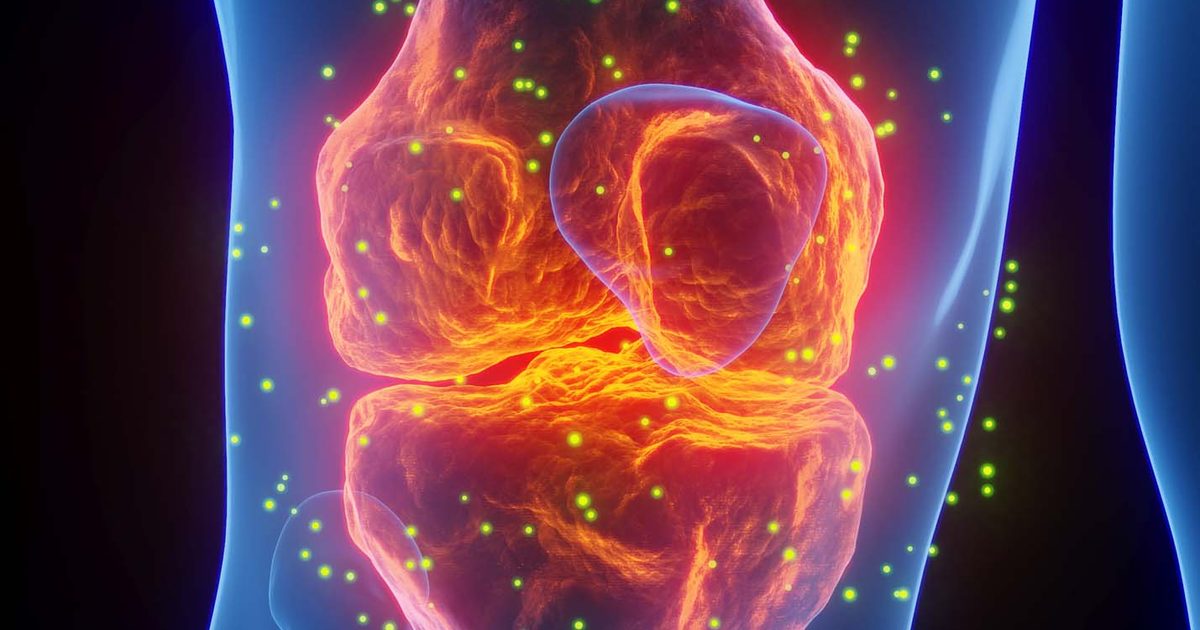 The surprising health condition you thought had died out – but 96 million people will be diagnosed with in the next 25 years