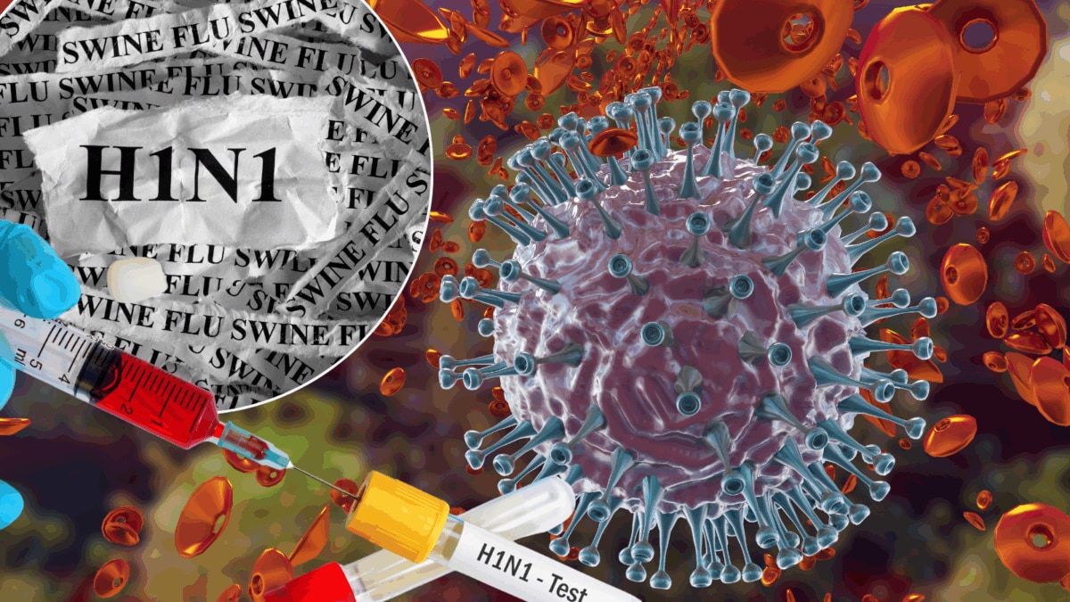 Nagpur Confirms First H1N1 Death Of 2026 As Swine Flu Cases Surge: When Should You Seek Medical Help For Flu Symptoms? | Health and Fitness News